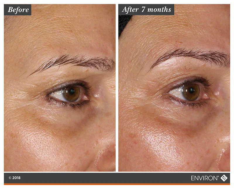Environ Tri Biobotanical Revival Masque results Environ Tri Biobotanical Revival Masque