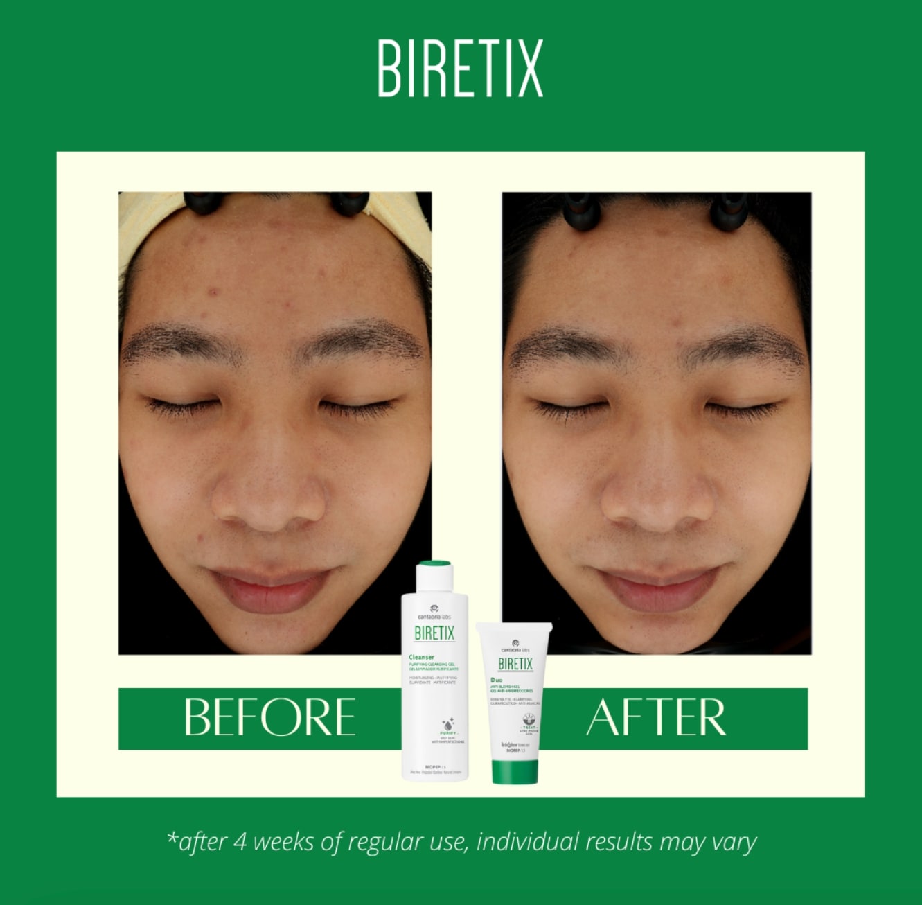 Biretix duo and cleanser Biretix duo and cleanser